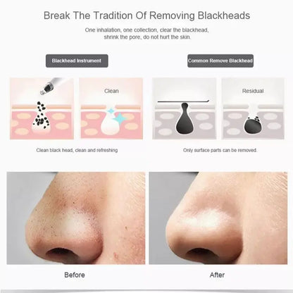 Blackhead Remover Vacuum Pore Cleaner Electric Beauty Skin Care