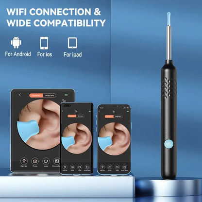 Kit de Nettoyage des Oreilles avec Caméra Haute Définition et Batterie Rechargeable - Technologie Intelligente pour un Nettoyage Doux et Efficace des Oreilles